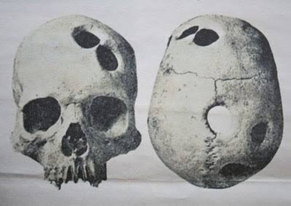 Fóssil de um crânio humano de cerca de 10.000 a.C